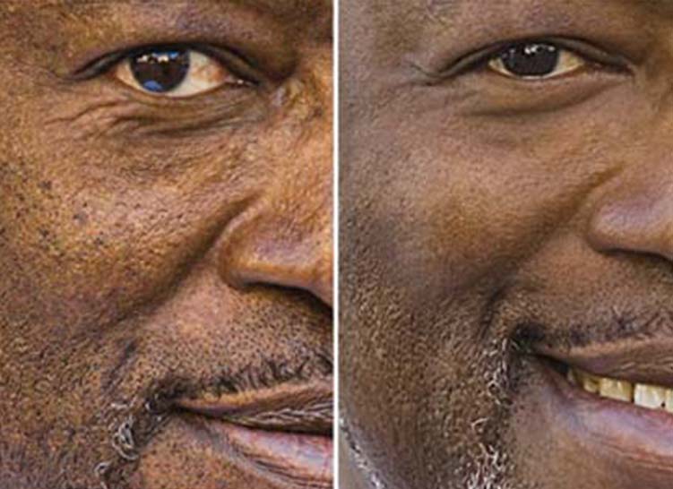 Close-up of man's face with visible skin texture before and after using skin care cream.